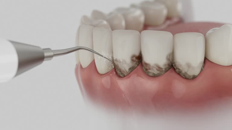 Reliable Dental Implants contractor in St. James, MO by Smile Center Dentistry